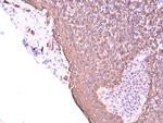 Cytokeratin 5 Antibody in Immunohistochemistry (Paraffin) (IHC (P))