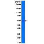 Cytokeratin 5 Antibody in Western Blot (WB)