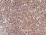 NFkB p50/p105 Recombinant Rabbit Monoclonal Antibody (RM299)