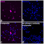 CD21 Recombinant Rabbit Monoclonal Antibody (RM372)