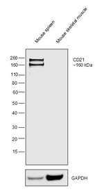 CD21 Antibody