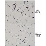 AKT1 (E17K Mutant) Recombinant Rabbit Monoclonal Antibody (RM336)