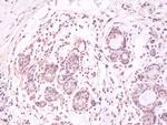 AKT1 (PH domain) Antibody in Immunohistochemistry (Paraffin) (IHC (P))