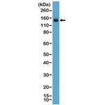 MSH6 Antibody in Western Blot (WB)