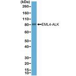ALK Recombinant Rabbit Monoclonal Antibody (RM361)