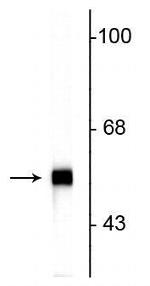 Peripherin Antibody in Western Blot (WB)