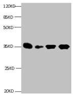 IGFBP-1 Monoclonal Antibody (1E1B2)