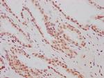HIF-1 beta Antibody in Immunohistochemistry (Paraffin) (IHC (P))