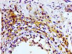 CD81 Antibody in Immunohistochemistry (Paraffin) (IHC (P))