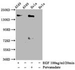 Phospho-EGFR (Tyr1092) Recombinant Rabbit Monoclonal Antibody (3H9)