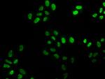 FEN1 Recombinant Rabbit Monoclonal Antibody (4D9)