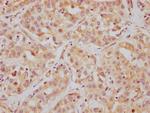 HDAC6 Recombinant Rabbit Monoclonal Antibody (2H12)