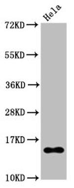 H2BK20ac (type 1-B) Antibody in Western Blot (WB)