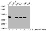 Phospho-ERK1/ERK2 (Thr185, Tyr187, Thr202, Tyr204) Recombinant Rabbit Monoclonal Antibody (4F6)