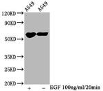Phospho-PAK1/2/3 (Ser139, Ser141, Ser144) Antibody in Western Blot (WB)