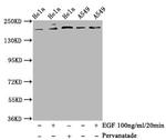 Phospho-PDGFRB (Tyr740) Recombinant Rabbit Monoclonal Antibody (3B8)