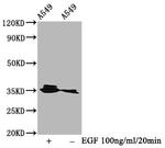 Phospho-PP2A alpha (Tyr307) Recombinant Rabbit Monoclonal Antibody (3F11)
