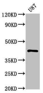 PRKAR1A Antibody in Western Blot (WB)