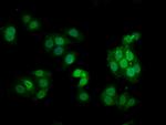 Phospho-PKC alpha (Thr638) Antibody in Immunocytochemistry (ICC/IF)