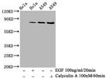 Phospho-PKC alpha (Thr638) Antibody in Western Blot (WB)