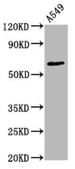 Phospho-PKC zeta (Thr560) Recombinant Rabbit Monoclonal Antibody (1B10)