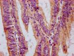 Phospho-c-Raf (Ser259) Antibody in Immunohistochemistry (Paraffin) (IHC (P))