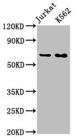 STIP1 Recombinant Rabbit Monoclonal Antibody (3E4)