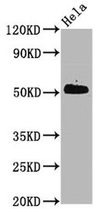 Phospho-CDC37 (Ser13) Recombinant Rabbit Monoclonal Antibody (3B3)