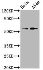 Phospho-SMAD2 (Ser250) Antibody in Western Blot (WB)