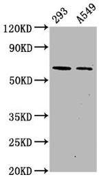 Phospho-AMPK alpha-2 (Ser491) Recombinant Rabbit Monoclonal Antibody (3H10)