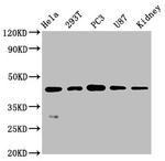 NDRG1 Antibody in Western Blot (WB)