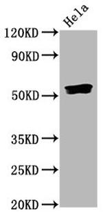 Phospho-SMAD5 (Ser463, Ser465) Recombinant Rabbit Monoclonal Antibody (3A9)