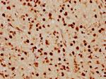 FTO Antibody in Immunohistochemistry (Paraffin) (IHC (P))