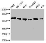 FTO Antibody in Western Blot (WB)