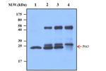 CD49e (Integrin alpha 5) Antibody in Western Blot (WB)