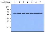 CD49e (Integrin alpha 5) Antibody in Western Blot (WB)