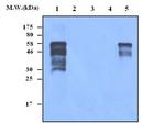 SMAD1/SMAD5 Antibody in Western Blot (WB)