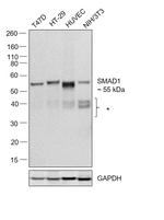 SMAD1/SMAD5 Antibody in Western Blot (WB)