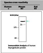 Thyroglobulin Antibody in Western Blot (WB)