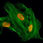 H4K8ac Recombinant Rabbit Monoclonal Antibody (RM201), ChIP-Verified