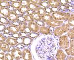 Cullin 4A Antibody in Immunohistochemistry (Paraffin) (IHC (P))