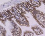 PTBP1 Antibody in Immunohistochemistry (Paraffin) (IHC (P))