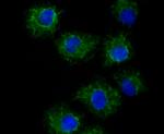 TYRP1 Recombinant Rabbit Monoclonal Antibody (JU36-48)