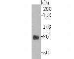 TYRP1 Antibody in Western Blot (WB)