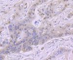 CK2 beta Recombinant Rabbit Monoclonal Antibody (JU37-62)