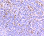 SEC23A Antibody in Immunohistochemistry (Paraffin) (IHC (P))
