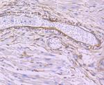 SEC23A Antibody in Immunohistochemistry (Paraffin) (IHC (P))