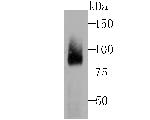 Coilin Recombinant Rabbit Monoclonal Antibody (JU44-08)