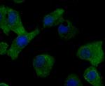 MMP17 Antibody in Immunocytochemistry (ICC/IF)