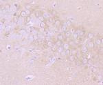 MMP17 Antibody in Immunohistochemistry (Paraffin) (IHC (P))